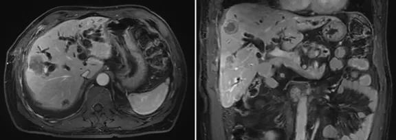 1633662585562665.png image.png